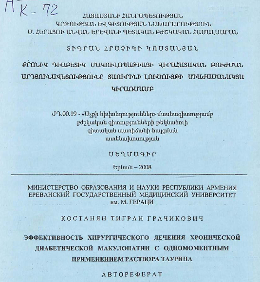 Эффективность хирургического лечения хронической диабетической макулопатии с одномоментным применением раствора таурина