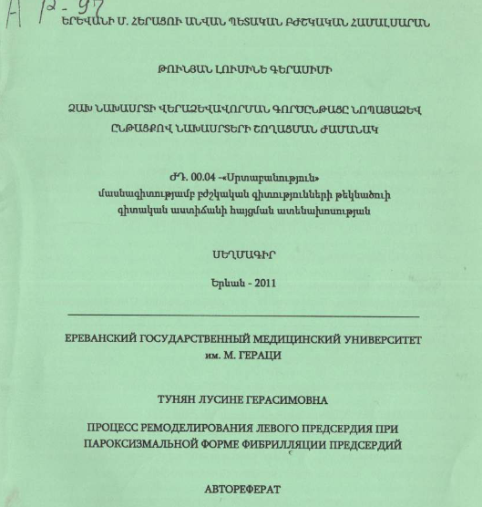 Ձախ նախասրտի վերաձևավորման գործընթացը նոպայաձև ընթացքով նախասրտերի շողացման ժամանակ