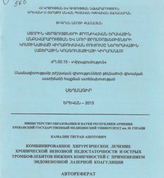 Ստորին վերջույթների քրոնիկական երակային անբավարարության և սուր թրոմբոֆլեբիտների կոմբինացված վիրաբուժական բուժումը ներերակային լազերային կոագուլյացիայի կիրառմամբ