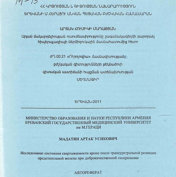 Исследование состояния свертываемости крови после трансуретральной резекции предстательной железы при доброкачественной гиперплазии