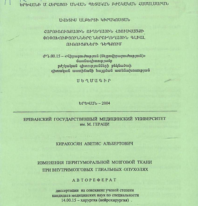 Изменения перитуморальной мозговой ткани при внутримозговых глиальных опухолях