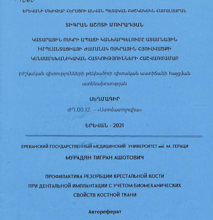 Профилактика резорбции крестальной кости при дентальной имплантации учетом биомеханических свойств костной ткани