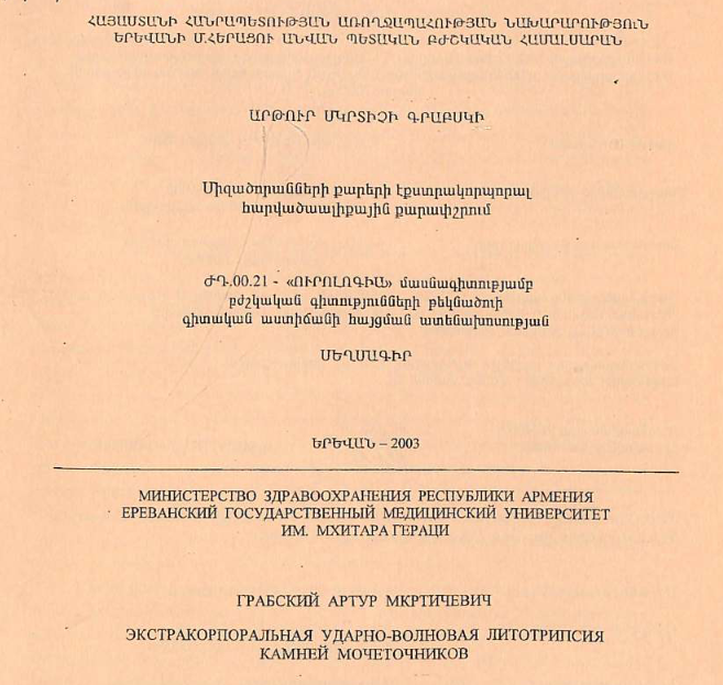 Экстракорпоральная ударно-волновая литотрипсия камней мочеточников