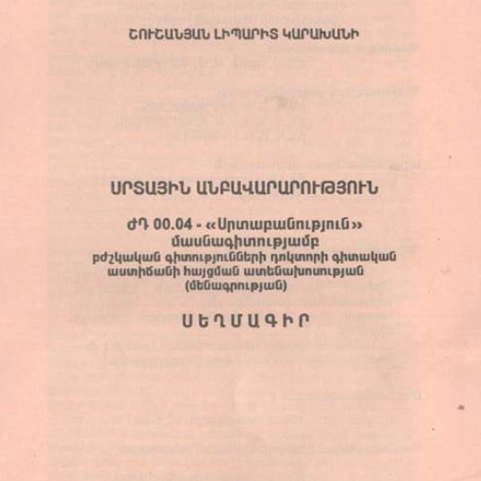 Սրտային անբավարարություն