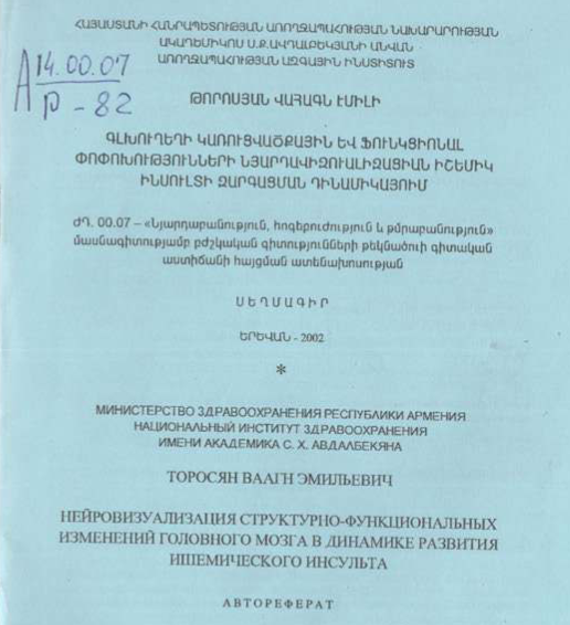 Գլխուղեղի կառուցվածքային և ֆունկցիոնալ փոփոխությունների նյարդավիզուալիզացիան իշեմիկ ինսուլտի զարգացման դինամիկայում