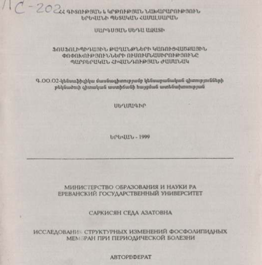 Исследования структурных изменений фосфолипидных мембран при периодической болезни