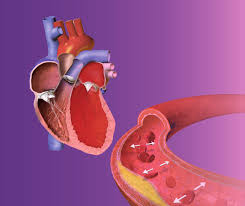 Ախտաբանական ֆիզիոլոգիա