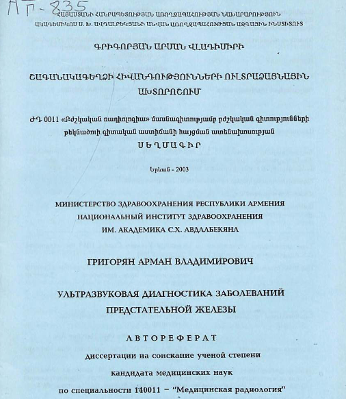 Ультразвуковая диагностика заболеваний предстательной железы