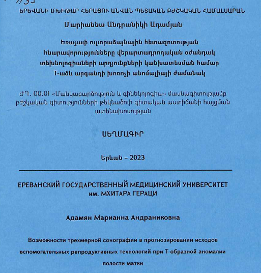 Возможности трехмерной сонографии прогнозировании исходов вспомогательных репродуктивных технологий при Т-образной аномалии полости матки