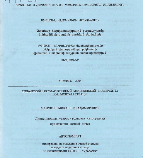 Дистанционная ударно - волновая литотрипсия при лечении камней почек