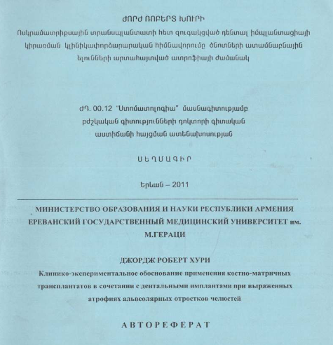 Ոսկրամատրիքսային տրանսպլանտատի հետ զուգակցված դենտալ իմպլանտացիայի կիրառման կլինիկափորձարարական հիմնավորումը ծնոտների ատամնաբնային ելունների արտահայտված ատրոֆիայի ժամանակ