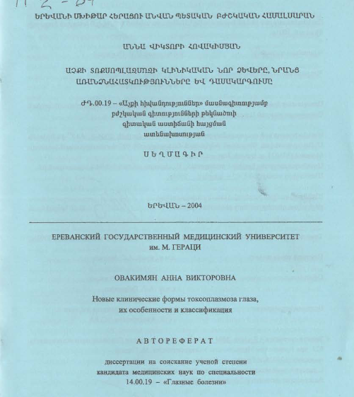 Աչքի տոքսոպլազմոզի կլինիկական նոր ձևերը, նրանց առանձնահատկությունները և դասակարգումը