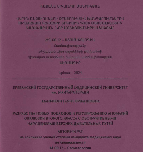 Разработка новых подходов к регулированию аномалий окклюзии второго класса с обструктивными нарушениями верхних дыхательных путей 
