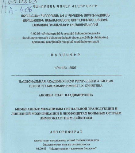 Мембранные механизмы сигнальной трансдукции липидной модификации в лимфоцитах больных острым лимфобластным лейкозом