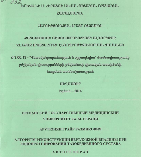 Алгоритм реконструкции вертлужной впадины при эндопротезировании тазобедренного сустава