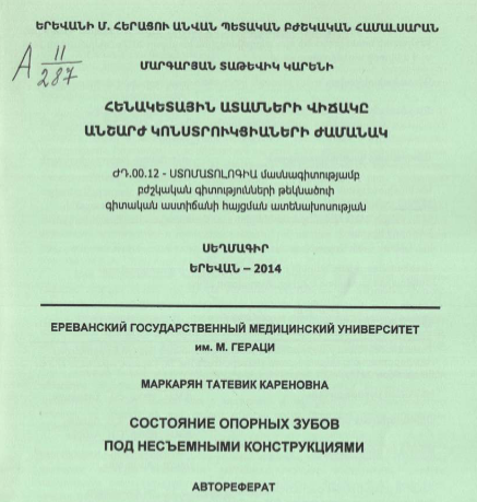 Состояние опорных зубов под несъемными конструкциями